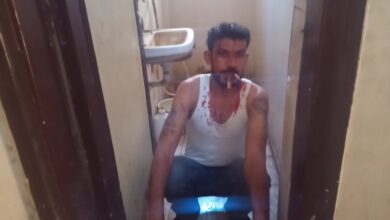 Photo of ضبط المواطن صاحب واقعة إغلاق فمه بـ”قفل حديدي” في نجع حمادي