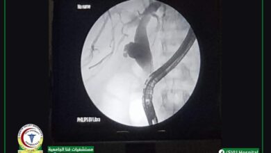 Photo of تدخل طبي عاجل لإنقاذ مريضة من الأقصر  بمستشفيات قنا الجامعية